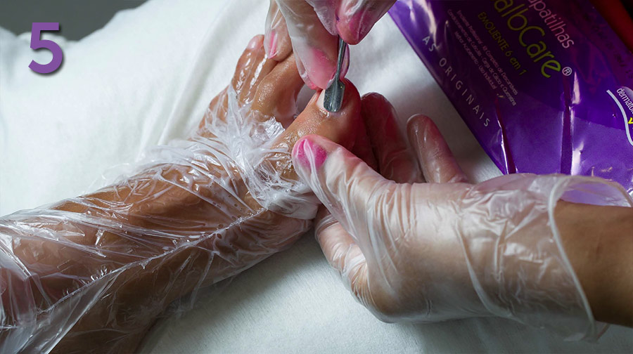 BalbCare sposób użycia krok5