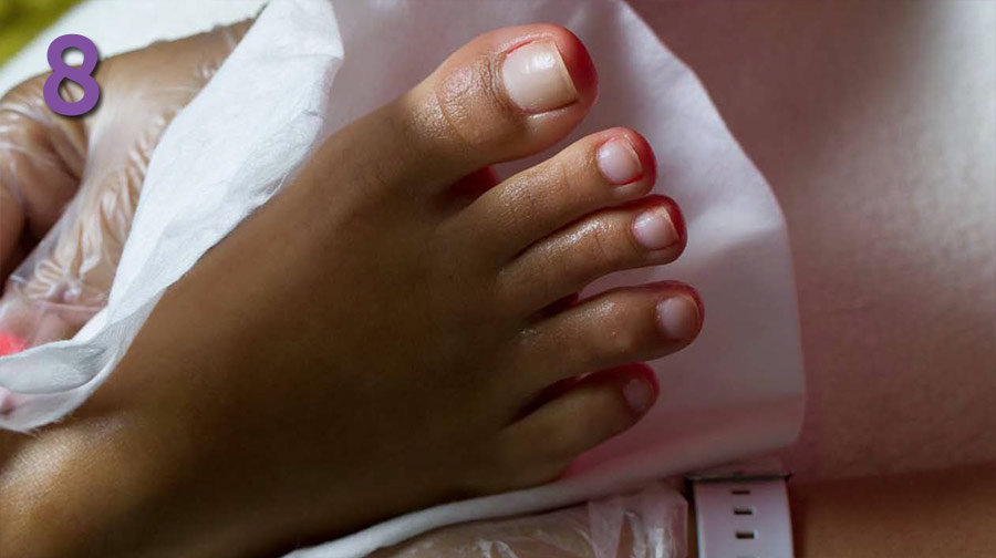 BalbCare sposób użycia krok8